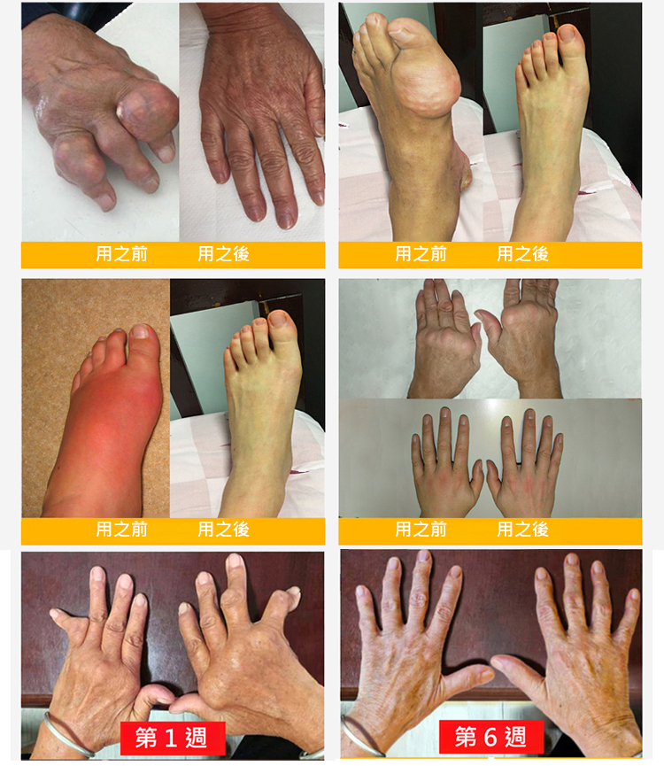 塑膠時光氨糖軟骨素鈣膠囊