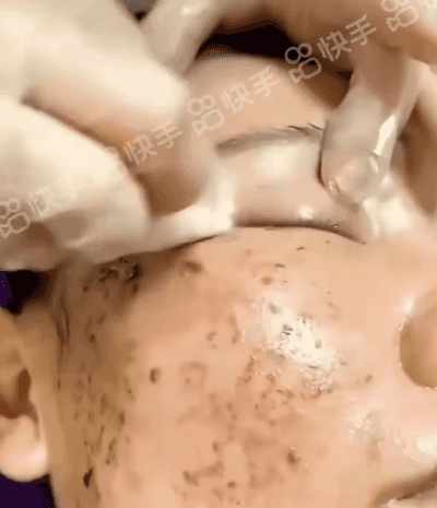 【老斑黃斑一抹消】淡斑尿素霜,Nicor維生素E尿素霜補水防凍防幹裂潤膚乳保濕身體乳100克每瓶 【老斑黃斑一抹消】淡斑尿素霜1729678871725815_07.gif