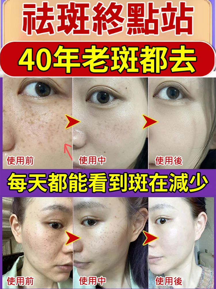 去黃美白黃耆霜