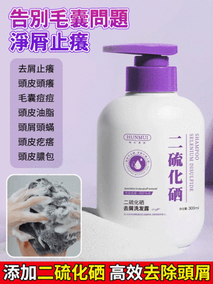 【拯救毛囊炎】二硫化硒去屑洗髮精