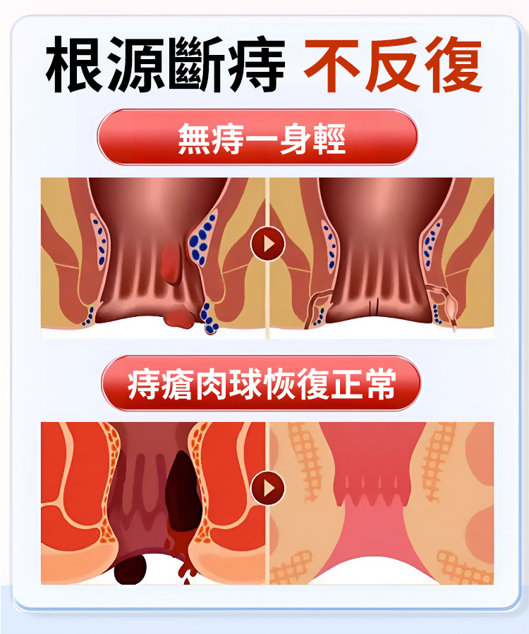【溫和修護】仁莘護消痔凝膠