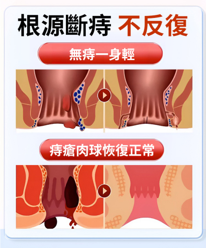 【溫和修護】仁莘護消痔凝膠