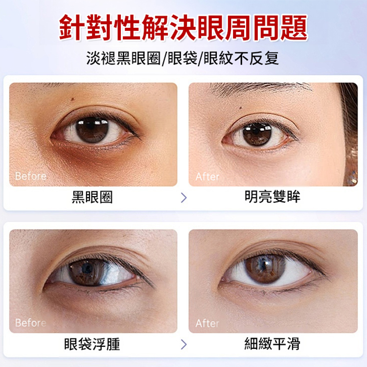 去皺淡紋眼部精華油
