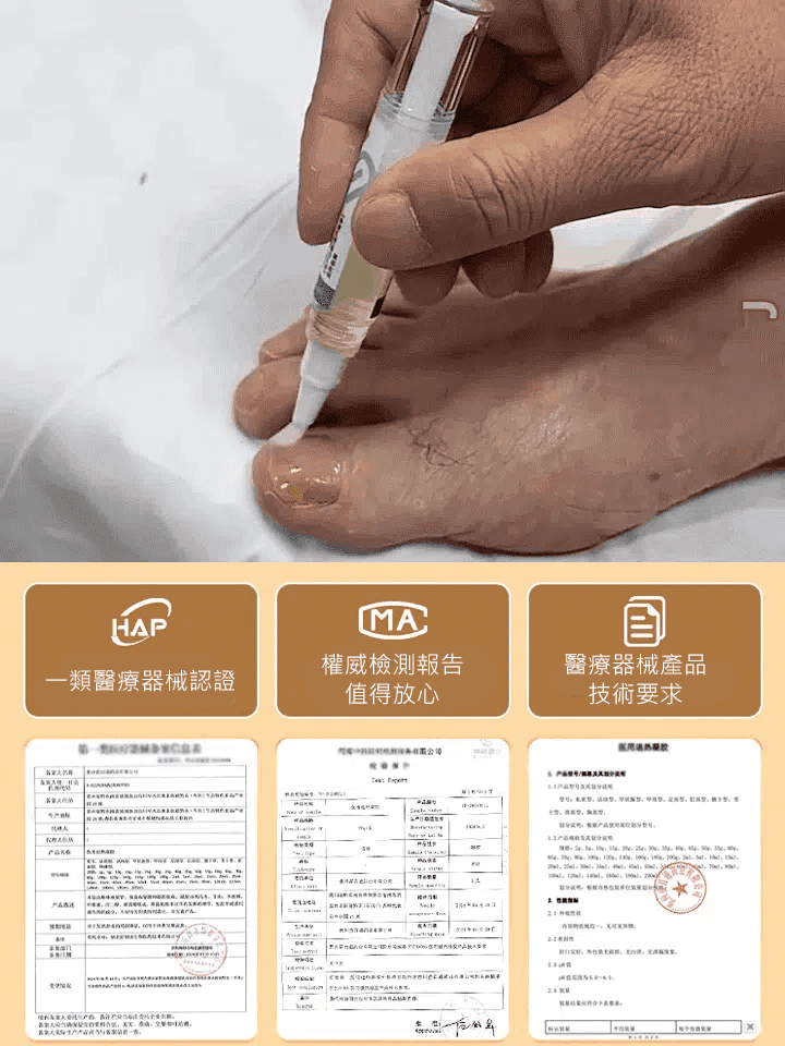 【一週手足灰甲全搞定】醫用灰指甲凝膠