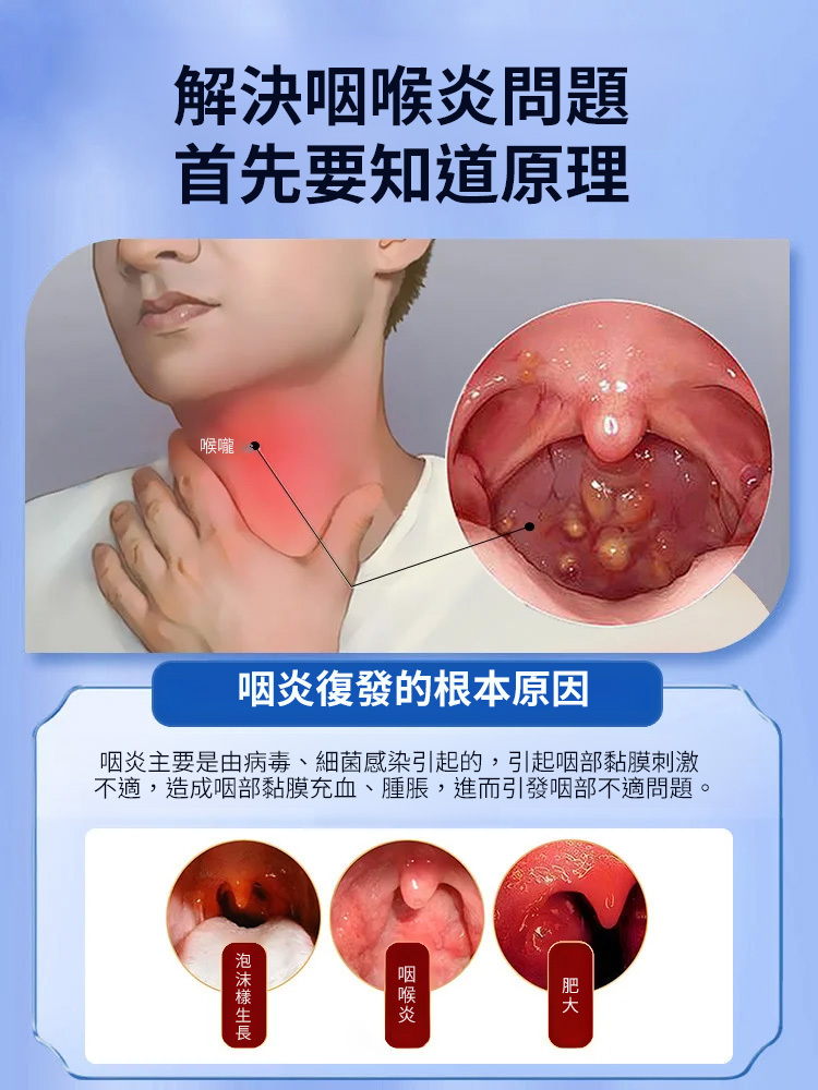 咽扁型退燒凝膠