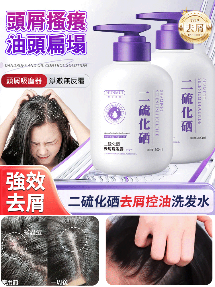 【拯救毛囊炎】二硫化硒去屑洗髮精