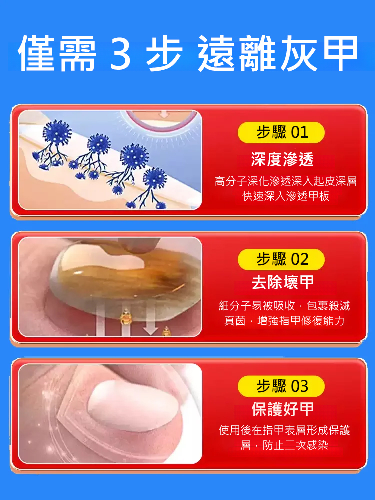 【一週手足灰甲全搞定】醫用灰指甲凝膠