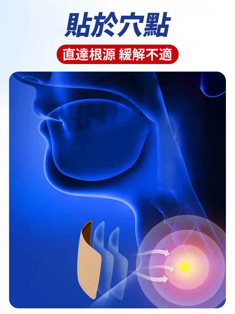 咽扁穴位磁療貼