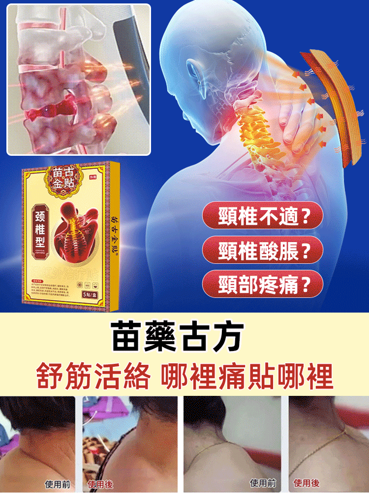【苗古金貼】頸椎型遠紅外治療貼