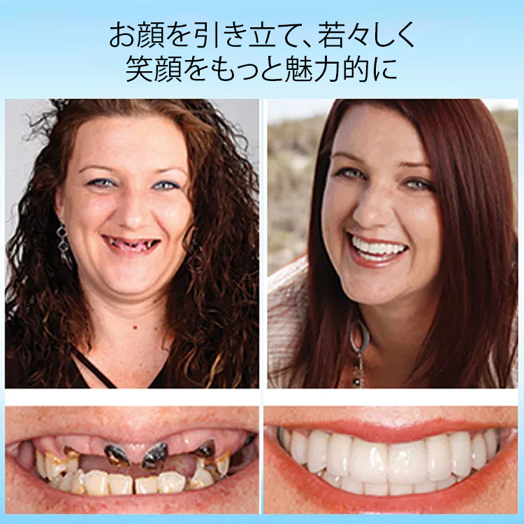 歯医者さんが推奨、歯の黄ばみ、歯の欠け、でこぼこ、不正咬合など、さまざまな歯の悩みをたった1秒で改善できる、70歳のおばあちゃんのお気に入り