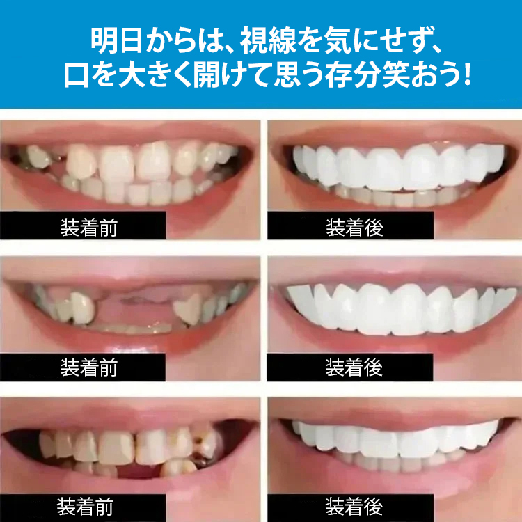 歯医者さんが推奨、歯の黄ばみ、歯の欠け、でこぼこ、不正咬合など、さまざまな歯の悩みをたった1秒で改善できる、70歳のおばあちゃんのお気に入り