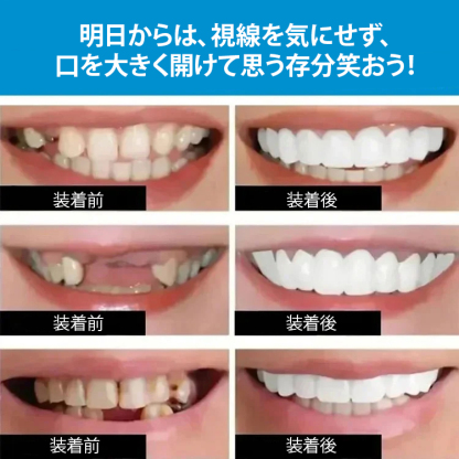 歯医者さんが推奨、歯の黄ばみ、歯の欠け、でこぼこ、不正咬合など、さまざまな歯の悩みをたった1秒で改善できる、70歳のおばあちゃんのお気に入り