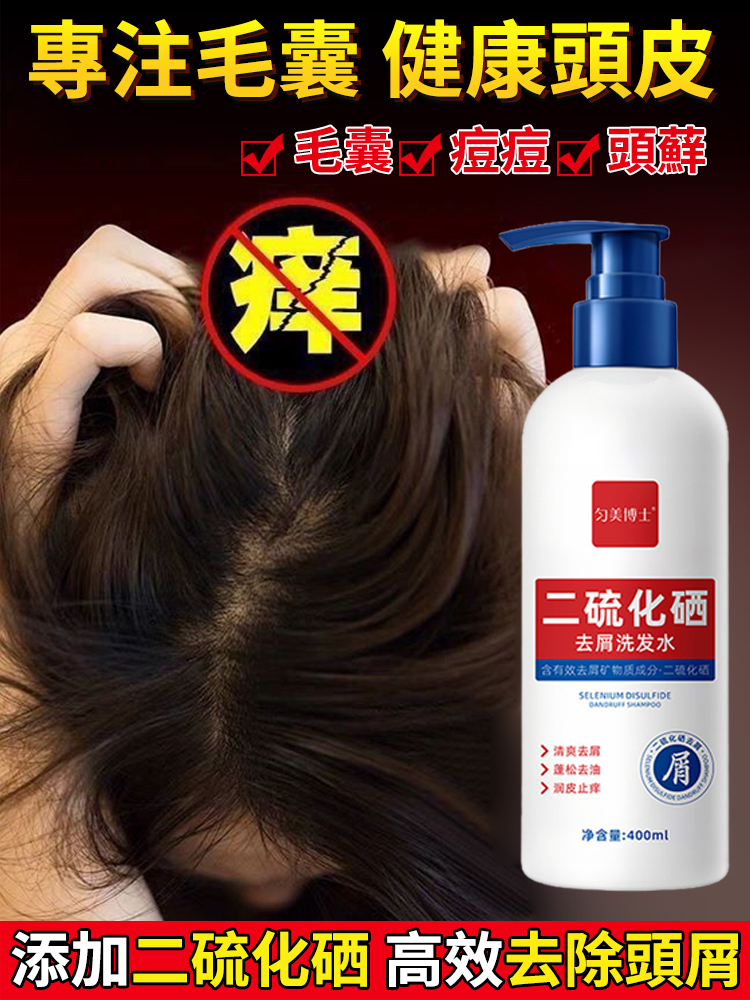 【專攻油痘屑癢】二硫化曬洗髮水