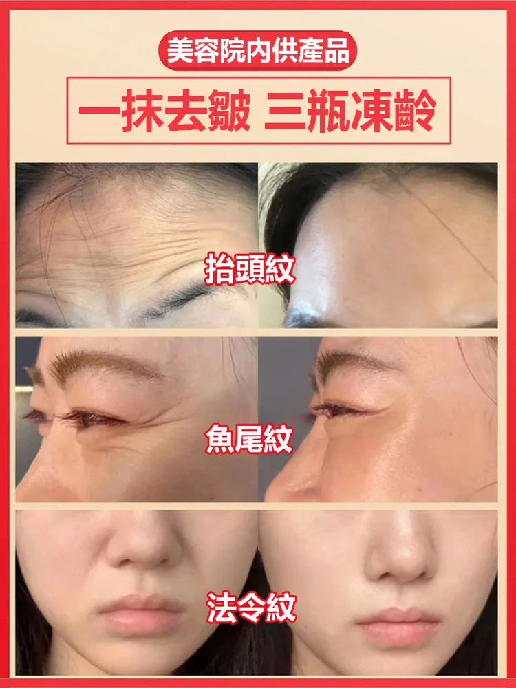 玻色因抗皺賦活霜