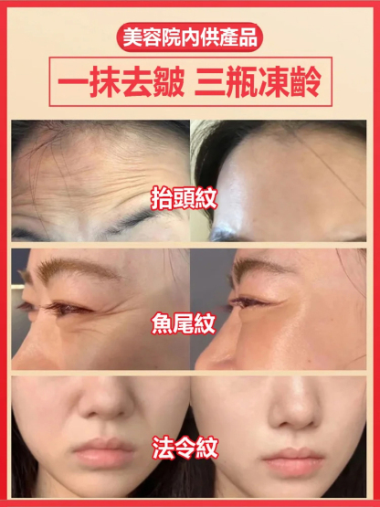 玻色因抗皺賦活霜