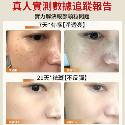 【黑斑消消消】清爽美白淡斑霜