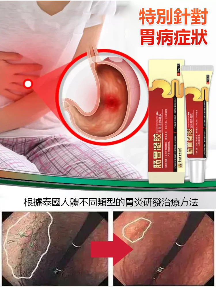 生物腸胃凝膠