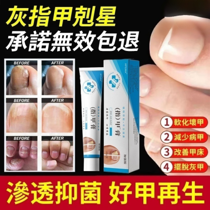 【無痛不復發】灰指甲膏