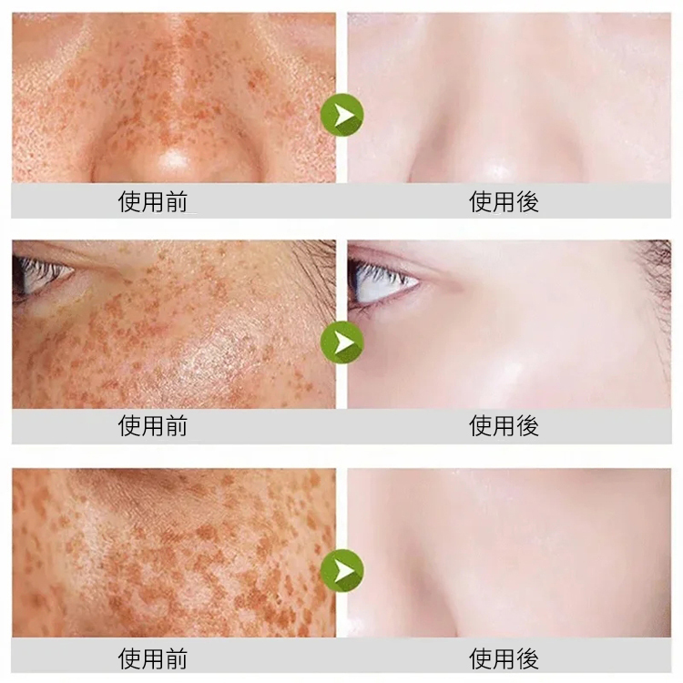 積雪草泡泡面膜