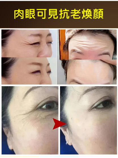 【專抹皺紋】勻美博士玻色因抗皺精粹乳