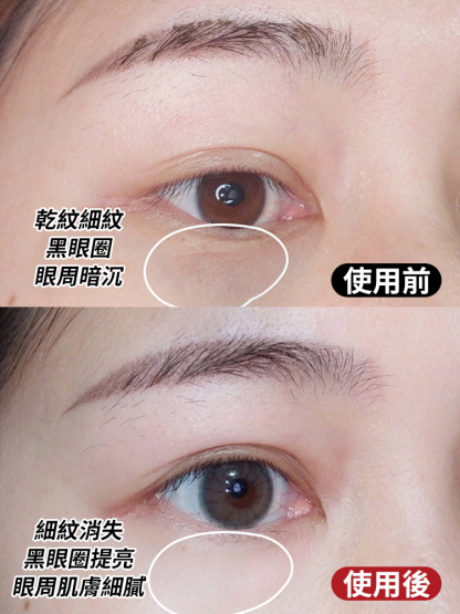 蛇毒勝肽煥膚提拉抗皺眼膜
