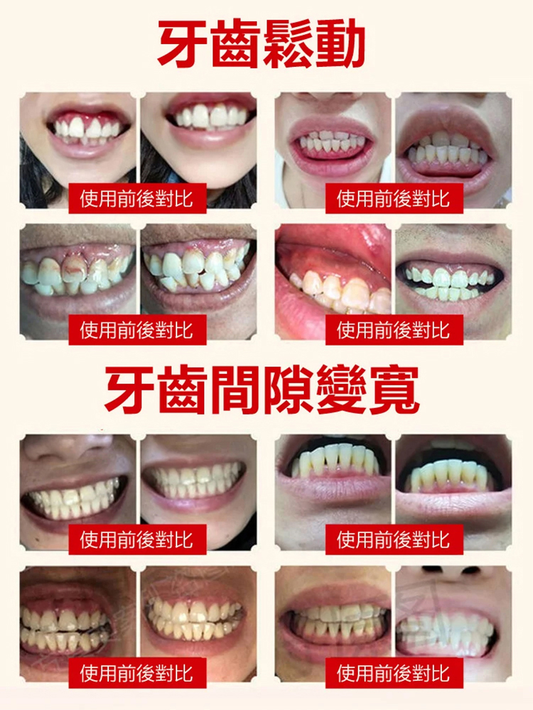 牙醫推薦，早晚兩次，修復+防禦，持久有效