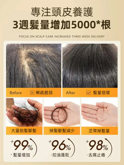 滾珠式按摩防脫髮液