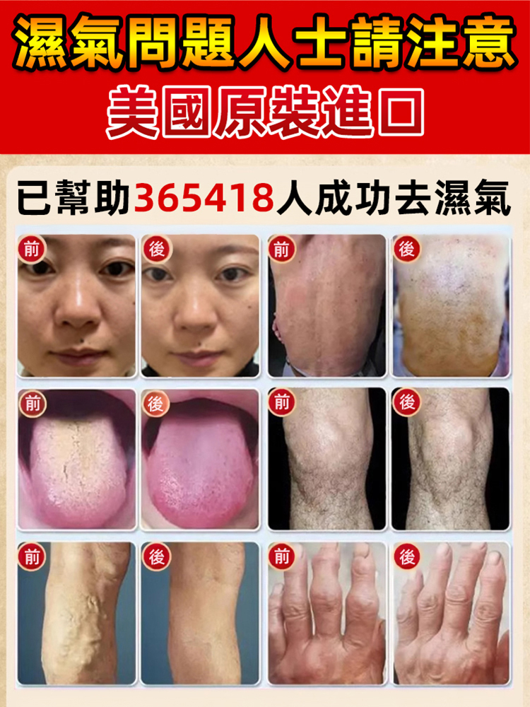 【1瓶見效】美國草本去濕片