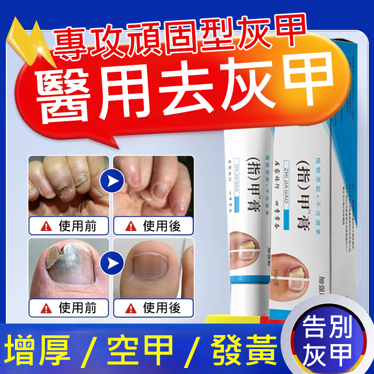 【無痛不復發】灰指甲膏