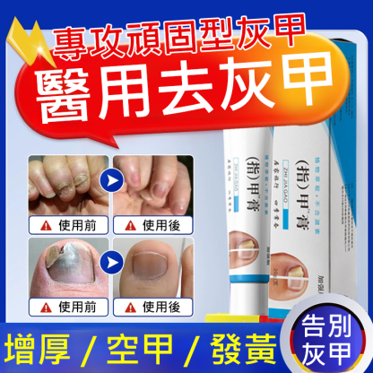 【無痛不復發】灰指甲膏