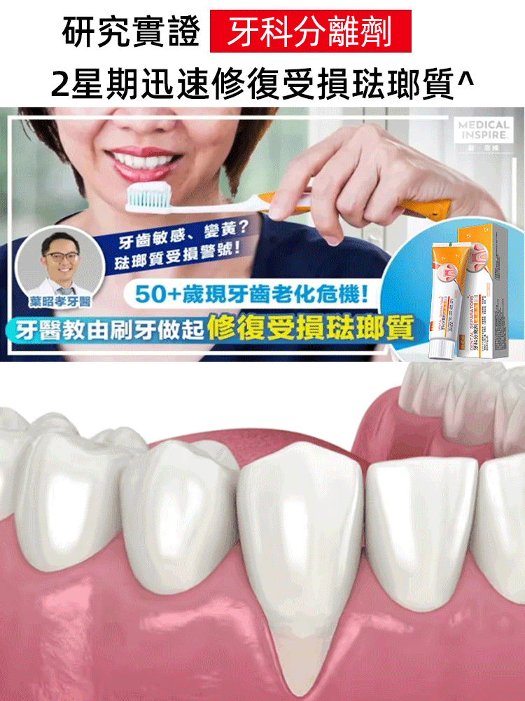 琺瑯質再生固齒美白牙科分離劑