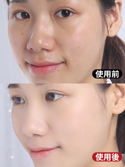 【老斑黃斑一洗消】菸鹼醯胺淡斑美白洗面乳