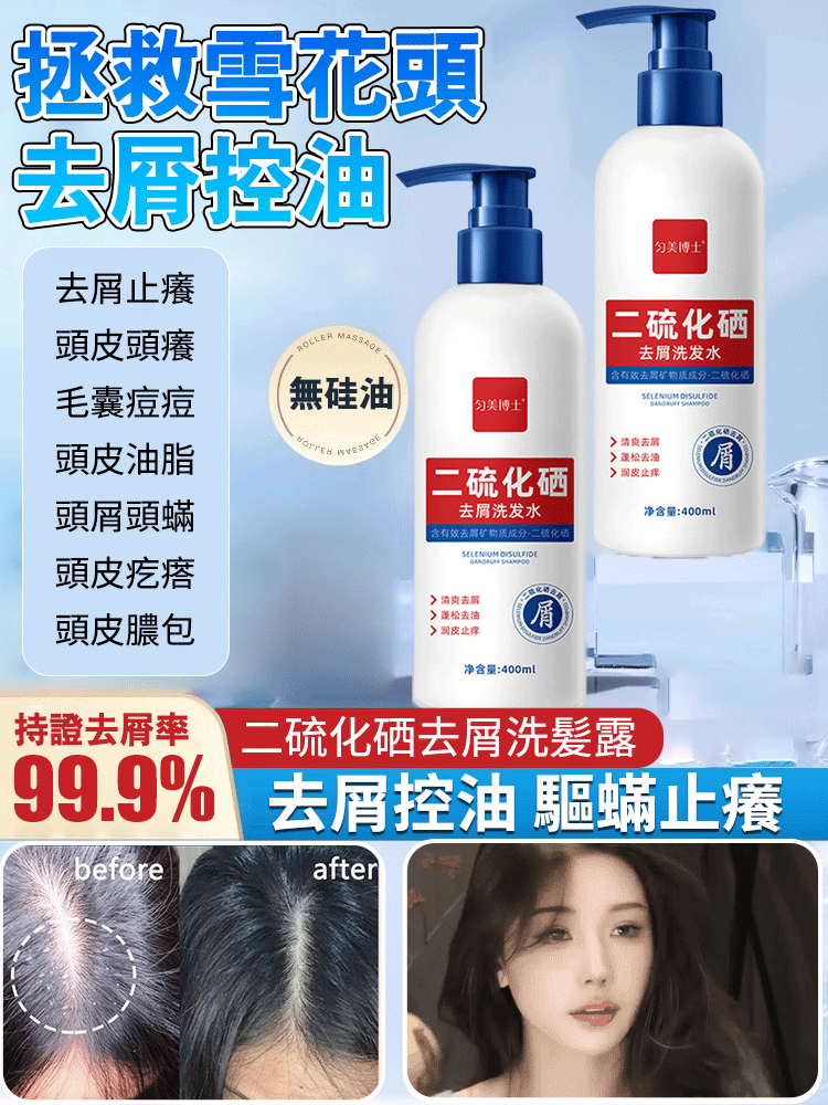 【專攻油痘屑癢】二硫化曬洗髮水