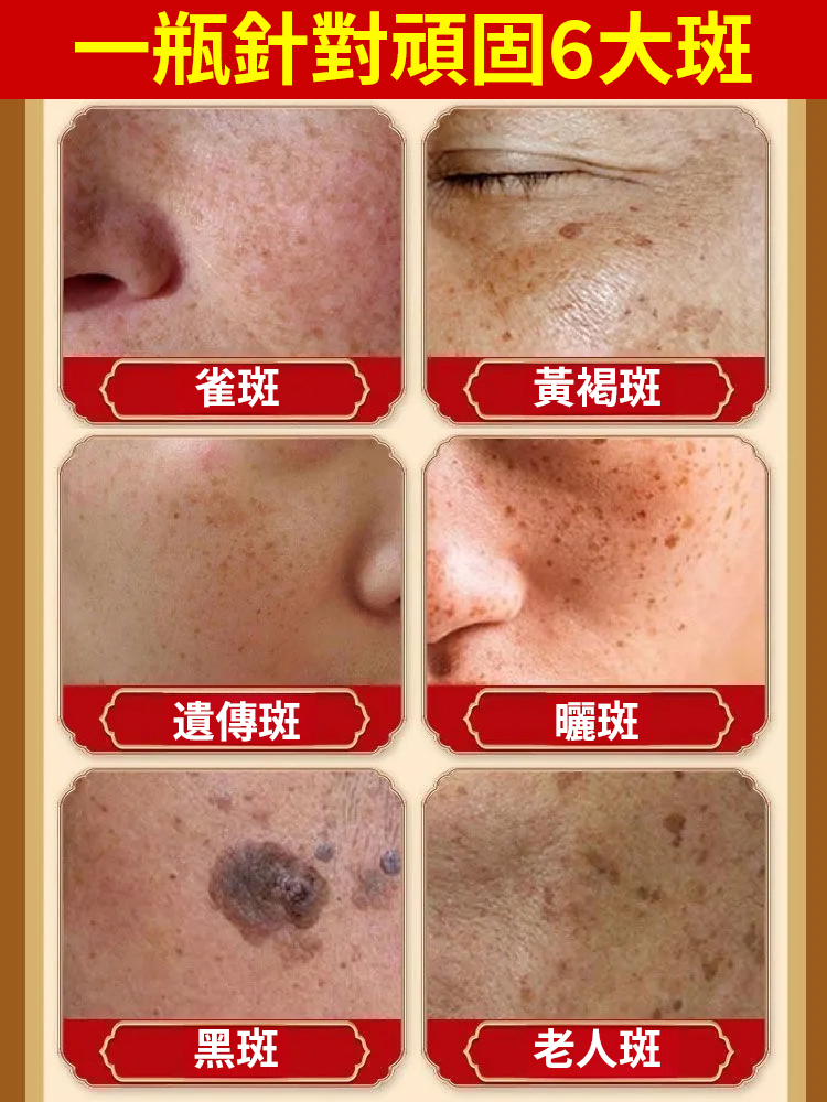 美白淡斑抑黑抗皺嫩膚面膜