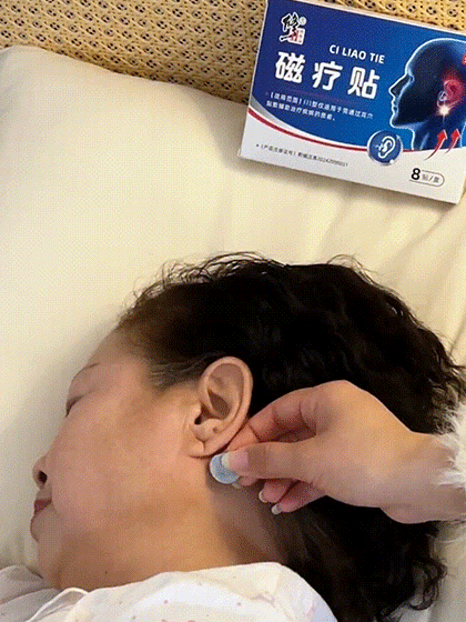 【專攻耳鳴耳聾】耳鳴磁療貼