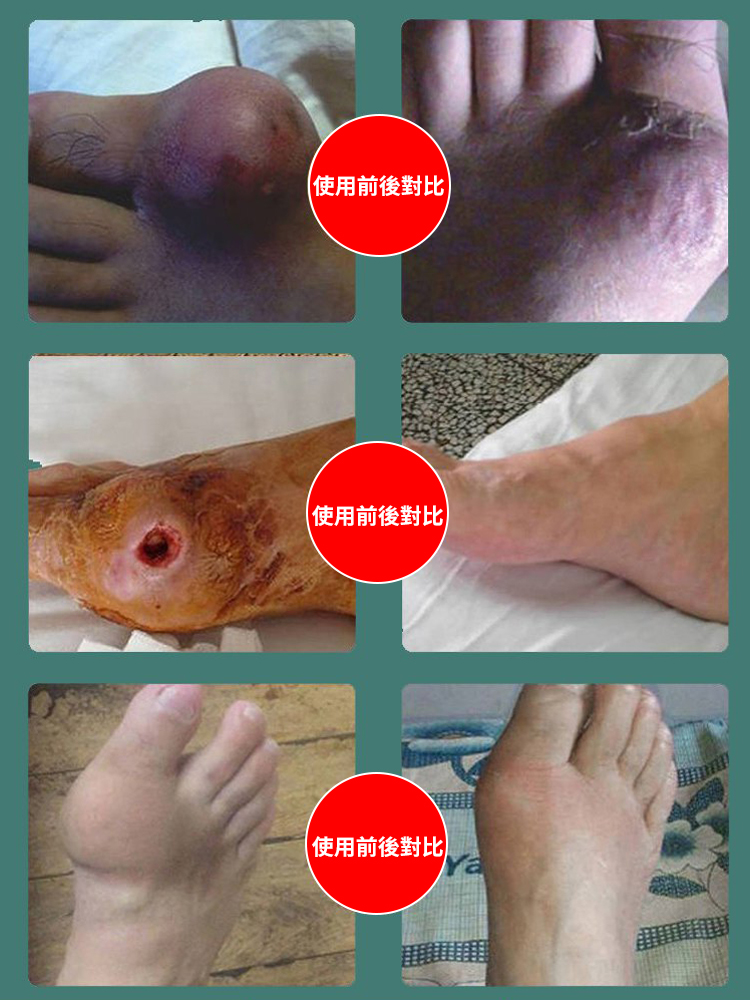 芹菜籽菊苣梔子片