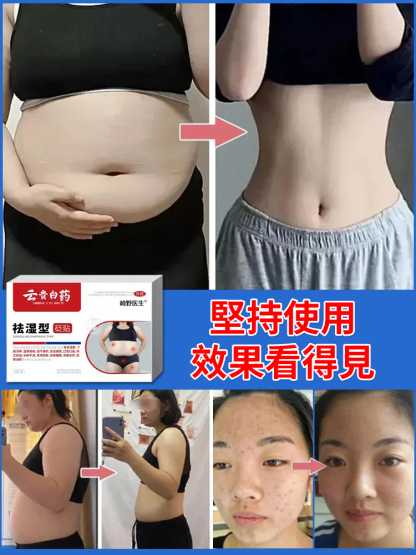 三天改善濕瘀體製祛濕型砭貼