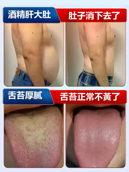 【護肝補氣明目好幫手】黃耆菊花枸杞茶
