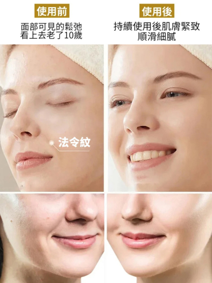 【7天法令紋消除】凝水微晶法令紋淡化面膜