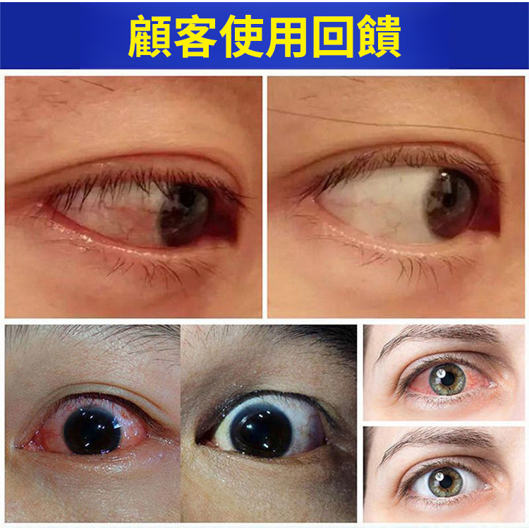 熊膽雪蓮葉黃素明目眼藥水