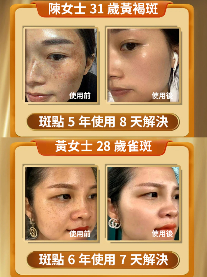 美白淡斑抑黑抗皺嫩膚面膜