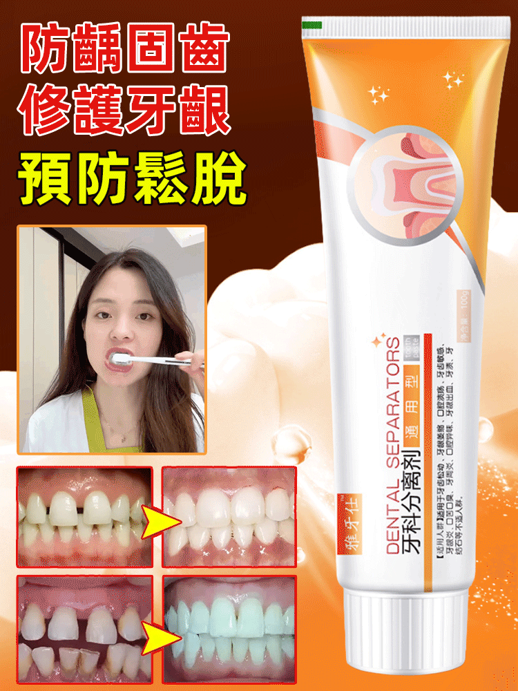 琺瑯質再生固齒美白牙科分離劑