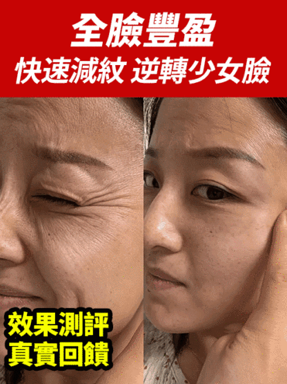 【28天淡紋】奢潤養膚黑霜