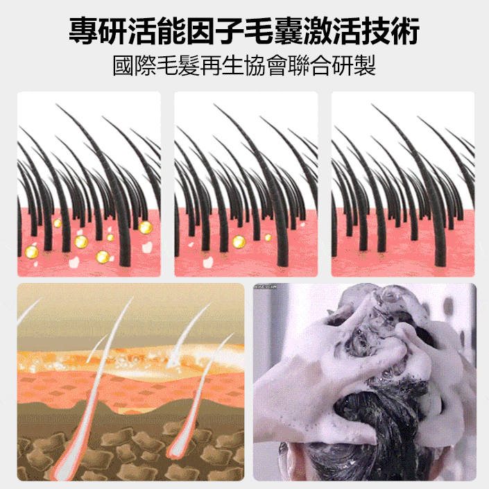 【頭髮爆增】滾珠防脫育髮液