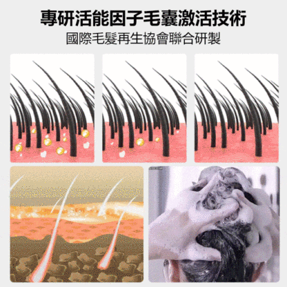 【頭髮爆增】滾珠防脫育髮液