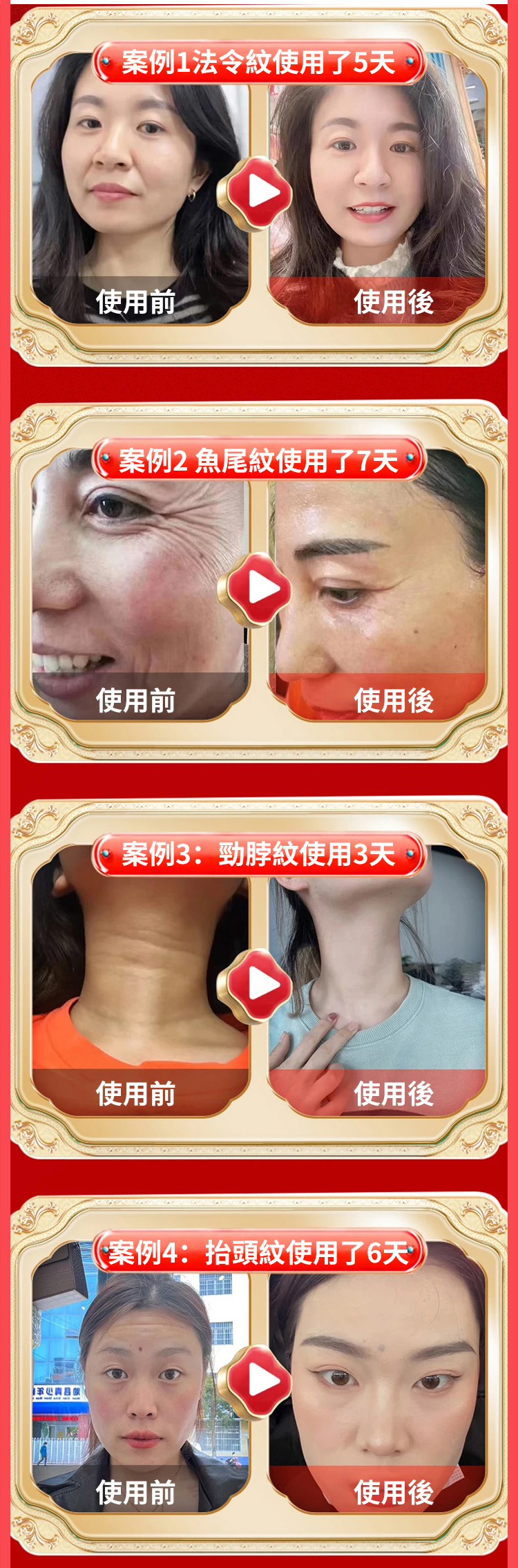 翻译件-SL-重组胶原蛋白抗皱精华液-1177382-系统_20.jpg