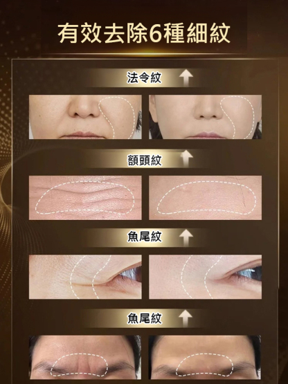 【專抹皺紋】勻美博士玻色因抗皺精粹乳