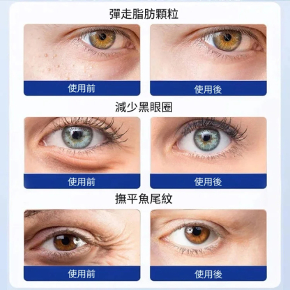 【3秒除皺】透明質酸微針眼貼