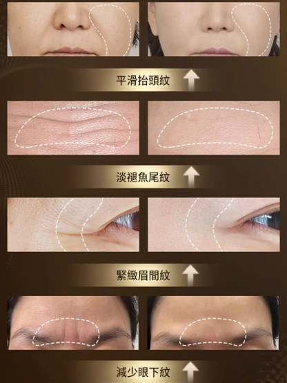 重組膠原抗皺保濕霜