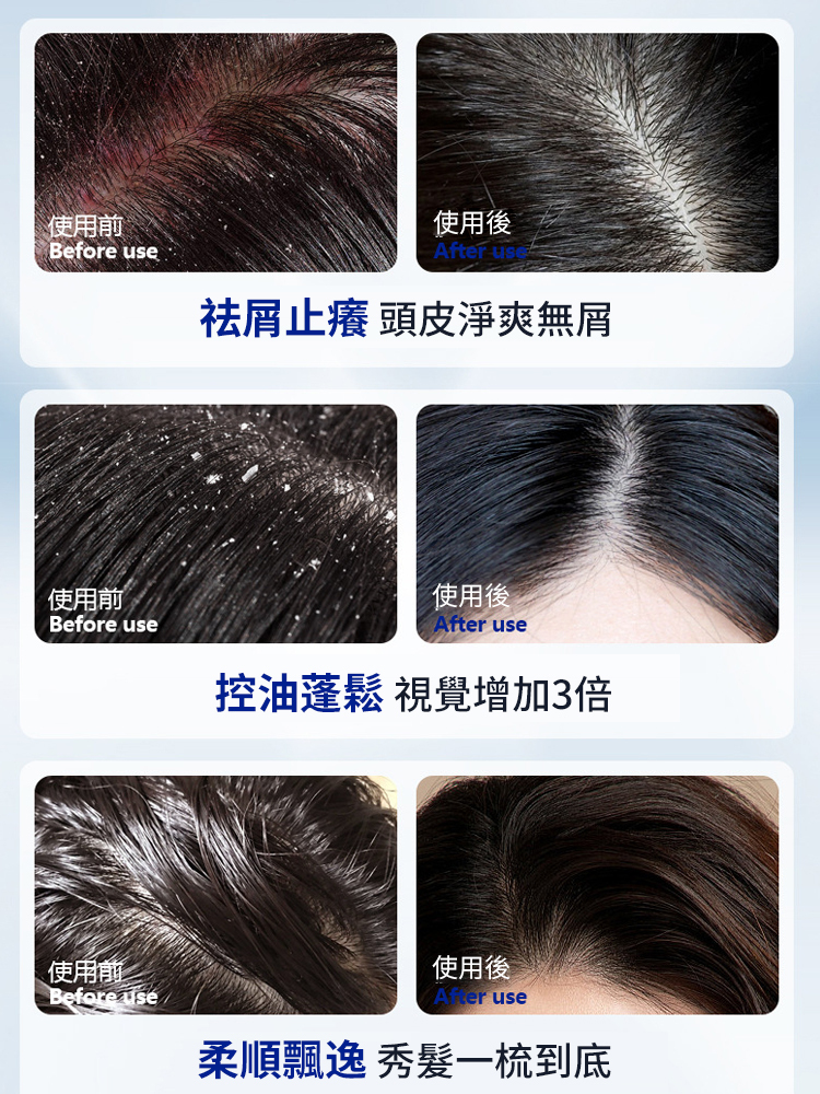 二硫化硒去屑止癢洗髮水